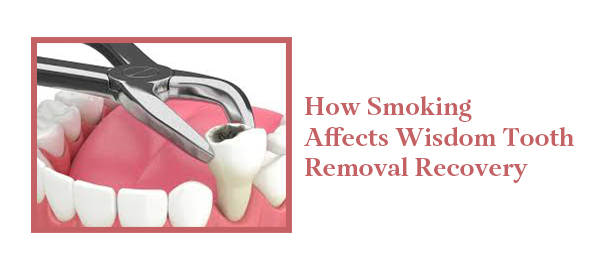 Extraction and Oral Surgery